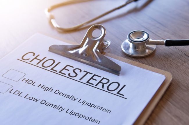 Closeup image of stethoscope and paper clipboard with text CHOLESTROL HDL and LDL .